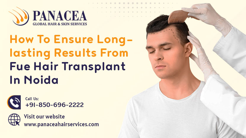 How to Ensure Long Lasting Results from FUE Hair Transplant in Noida