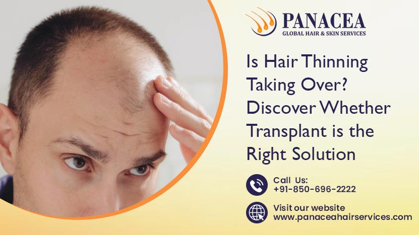 Is Hair Thinning Taking Over Discover Whether Transplant is the Right Solution