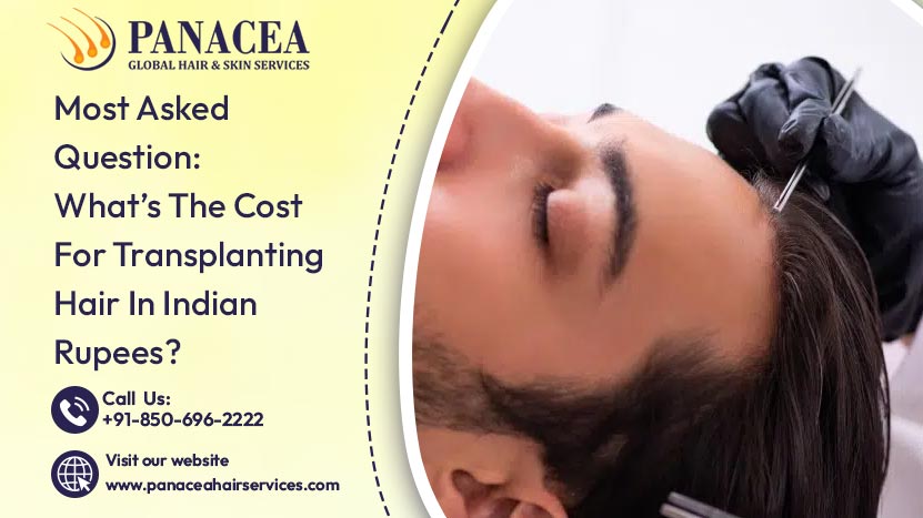 Most Asked Question What is The Cost For Transplanting Hair In Indian Rupees