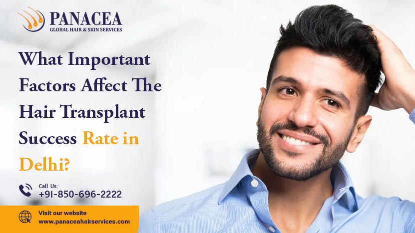 What Important Factors Affect the Hair Transplant Success Rate in Delhi