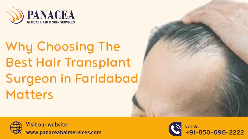 Why Choosing the Best Hair Transplant Surgeon in Faridabad Matters