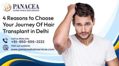 4 Reasons to Choose Your Journey Of Hair Transplant in Delhi