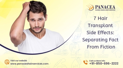 7 Hair Transplant Side Effects Separating Fact from Fiction