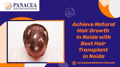 Achieve Natural Hair Growth in Noida with Best Hair Transplant in Noida
