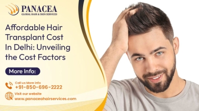 Affordable Hair Transplant Cost in Delhi: Unveiling the Cost Factors