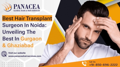 Best hair transplant Surgeon in Noida Unveiling the Best in Gurgaon and Ghaziabad