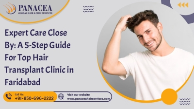 Expert Care Close By A 5 Step Guide For Top Hair Transplant Clinic in Faridabad
