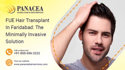FUE Hair Transplant in Faridabad The Minimally Invasive Solution