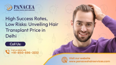 High Success Rates Low Risks Unveiling Hair Transplant Price in Delhi