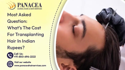 Most Asked Question What is The Cost For Transplanting Hair In Indian Rupees