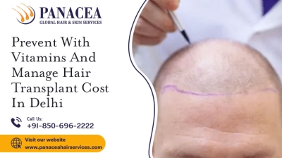 Prevent with Vitamins and Manage Hair Transplant Cost in Delhi