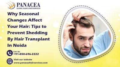 Why Seasonal Changes Affect Your Hair Tips to Prevent Shedding by Hair Transplant in Noida